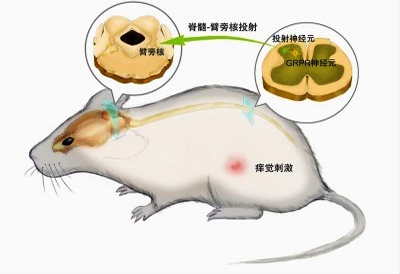 痒觉信息从脊髓到大脑的传递通路示意图