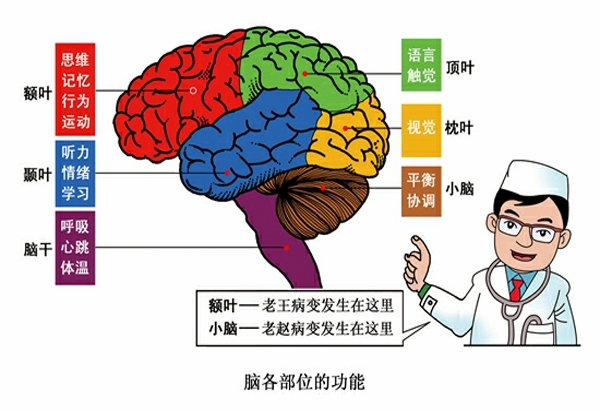 脑卒中发生在大脑各部位会影响人的哪些功能